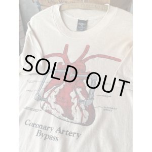 画像: CORONARY ARTERY BYPASS "MADE IN USA" VINTAGE T-SHIRTS